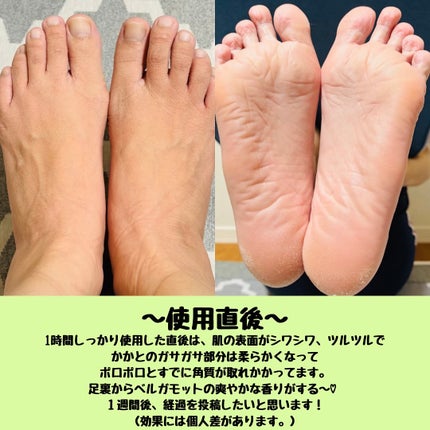 イージーパックDP60分タイプ/ベビーフット/レッグ・フットケアを使ったクチコミ(4枚目)