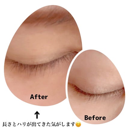 リアルミービオテノールラッシュアップアンプル/ベリサム/まつげ美容液を使ったクチコミ(4枚目)