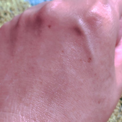 ジェルローション/キュレル/化粧水を使ったクチコミ(4枚目)