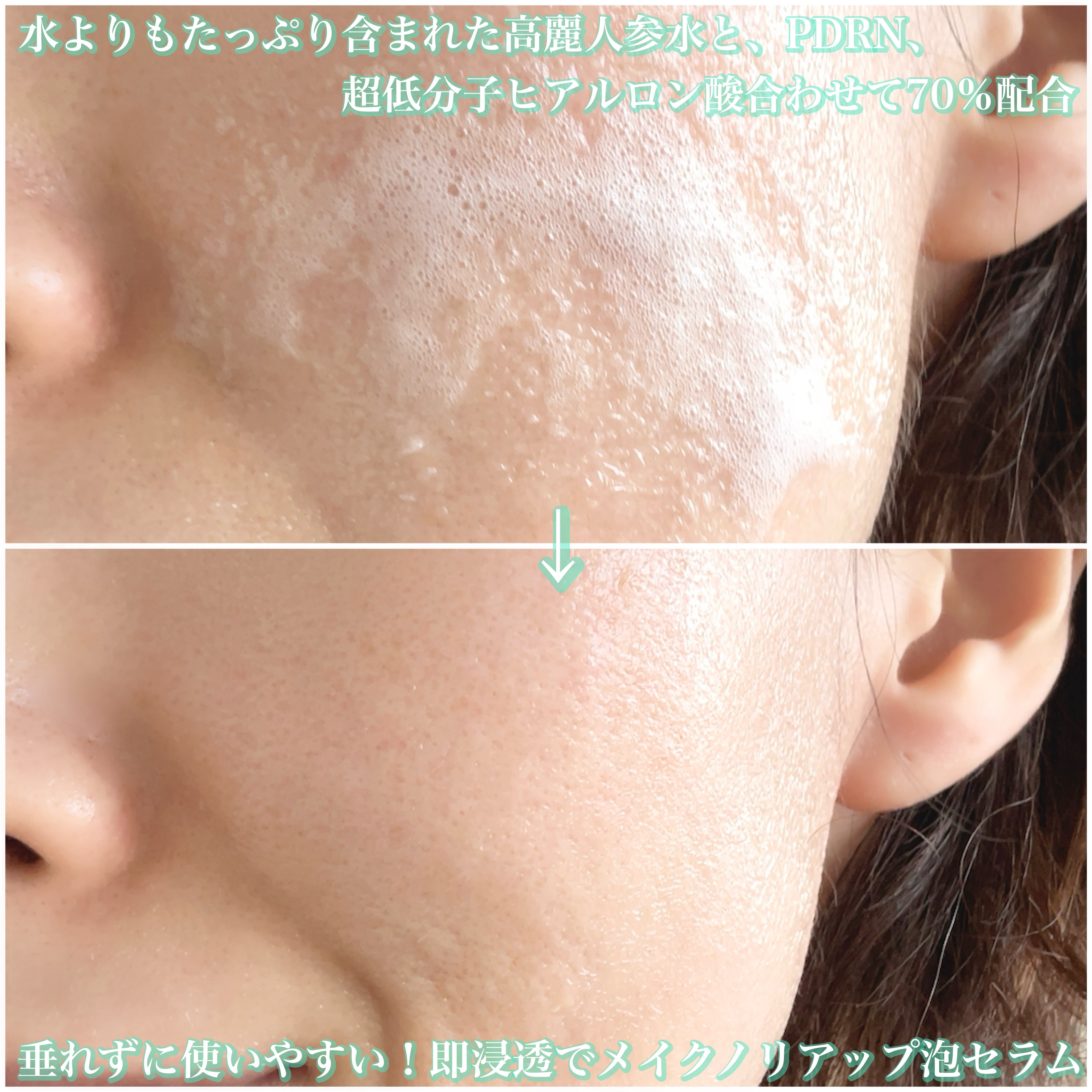 リードルS PDRN+ セラム/VT/美容液を使ったクチコミ（3枚目）