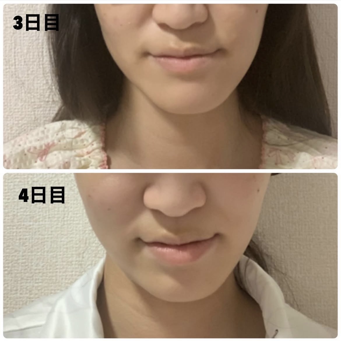 ReFa CARAT/ReFa/ボディケア美容家電を使ったクチコミ（3枚目）