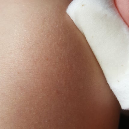 スキン ライトニング コンク/サイクルプラス/ブースター・導入液を使ったクチコミ(4枚目)