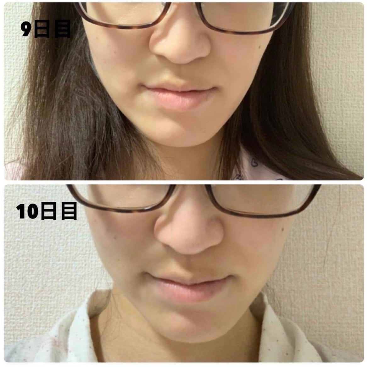 ReFa CARAT/ReFa/ボディケア美容家電を使ったクチコミ(6枚目)