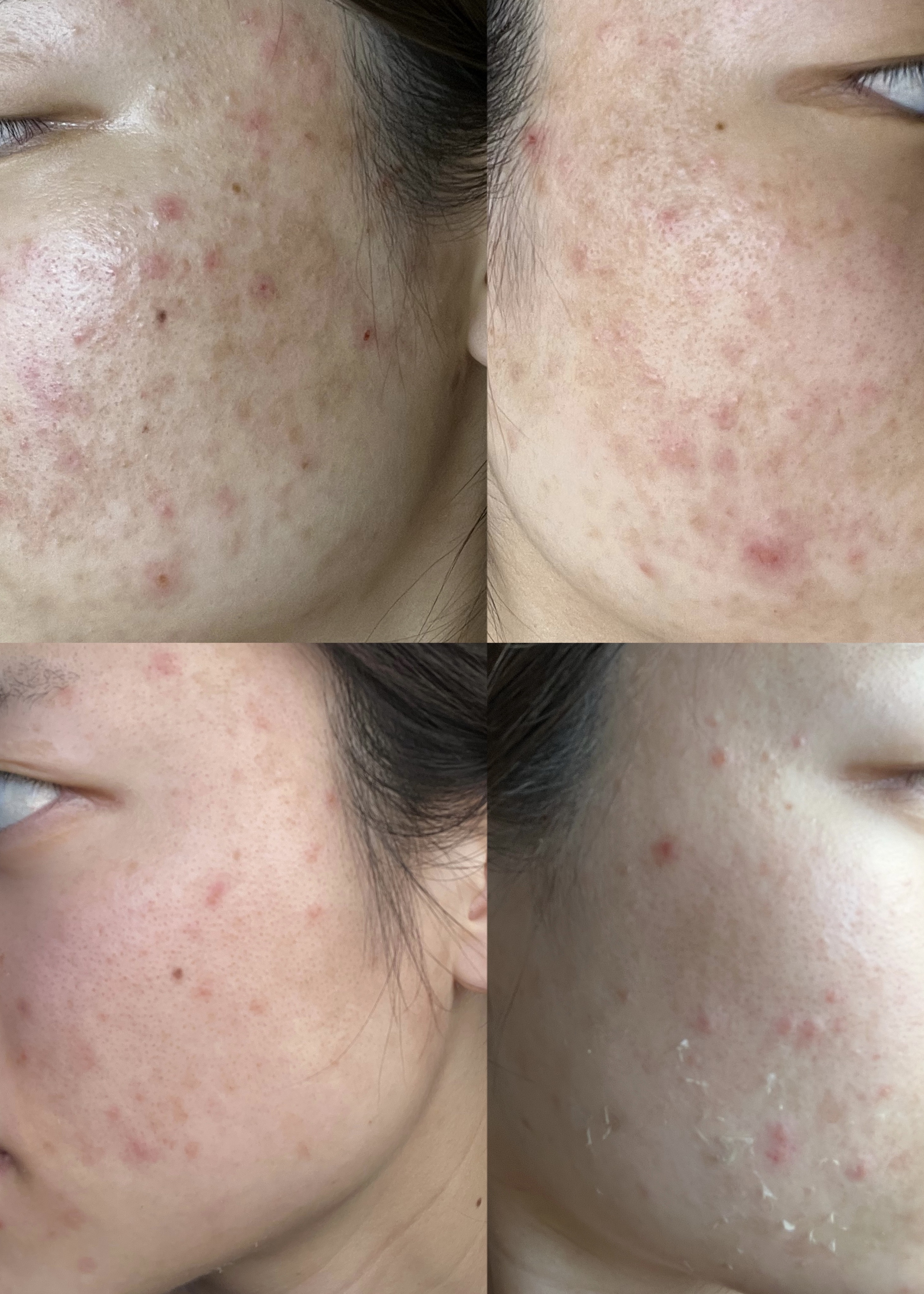 薬用ローション（とてもしっとり）/IHADA/化粧水を使ったクチコミ（1枚目）