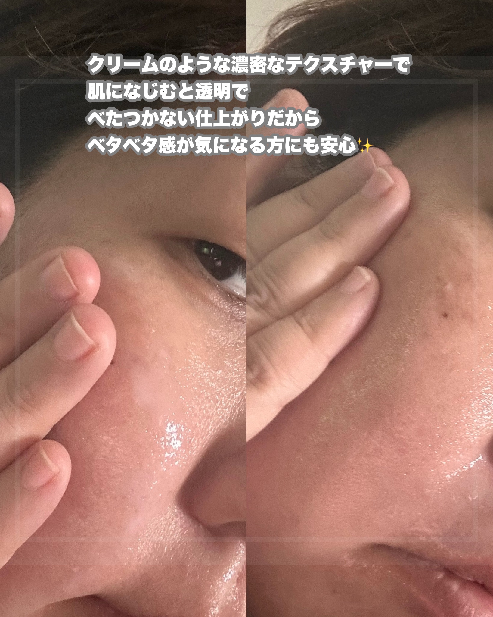 シナジーエフェクトBTXアンプル/MAXCLINIC/美容液を使ったクチコミ（3枚目）