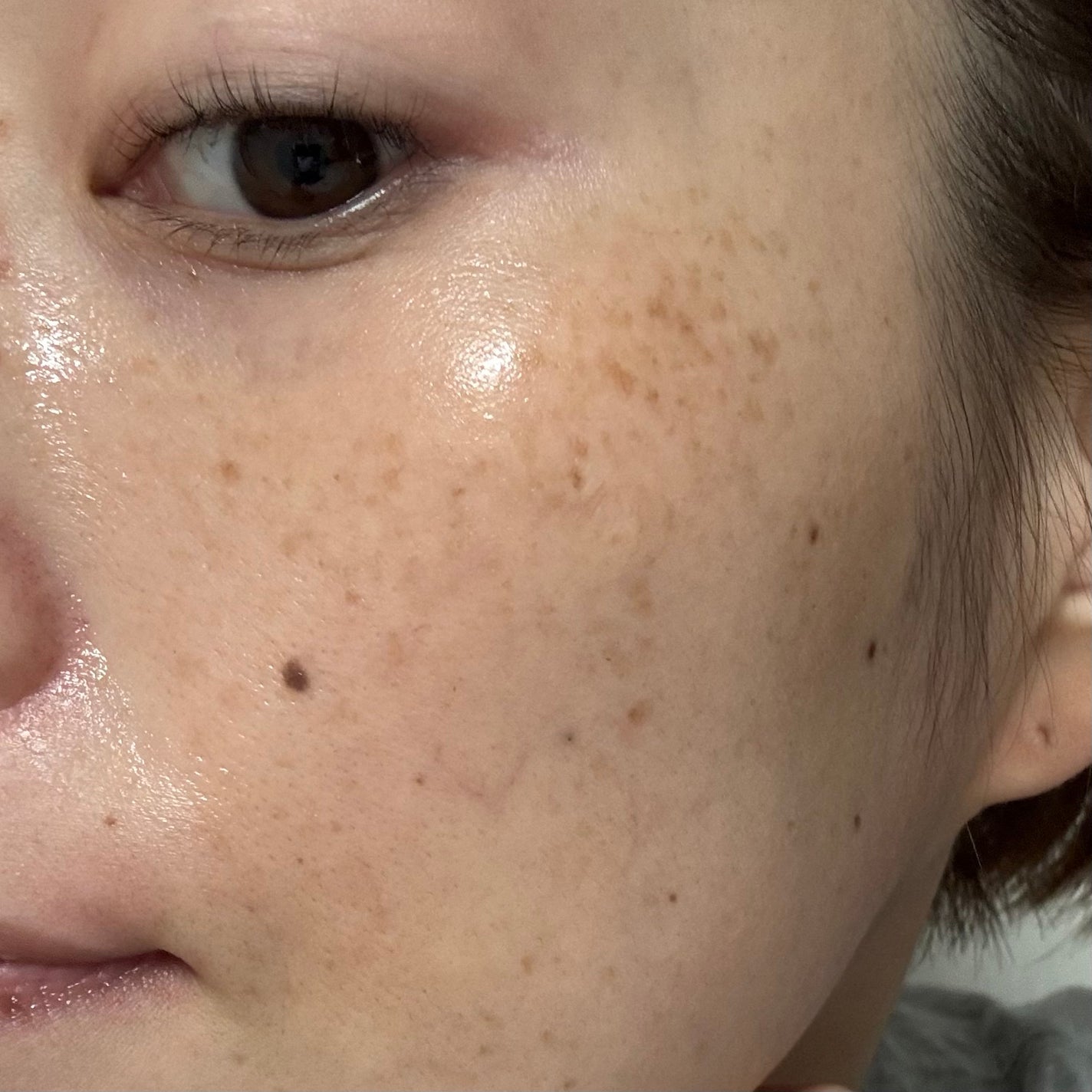 3D PDRN X コラーゲンアンプル/SKIN&LAB/美容液を使ったクチコミ(6枚目)