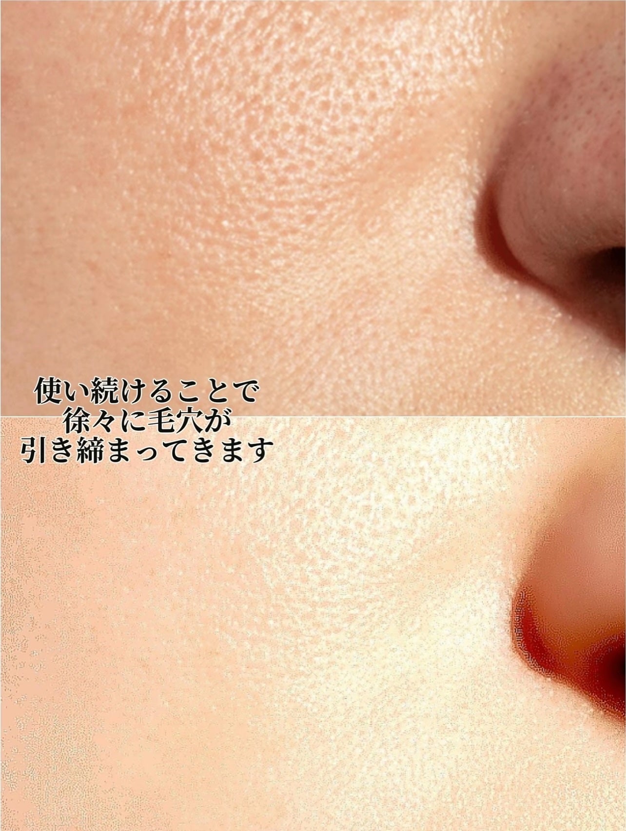 パントセラポアタイットンクリーム/KindStep/フェイスクリームを使ったクチコミ(5枚目)