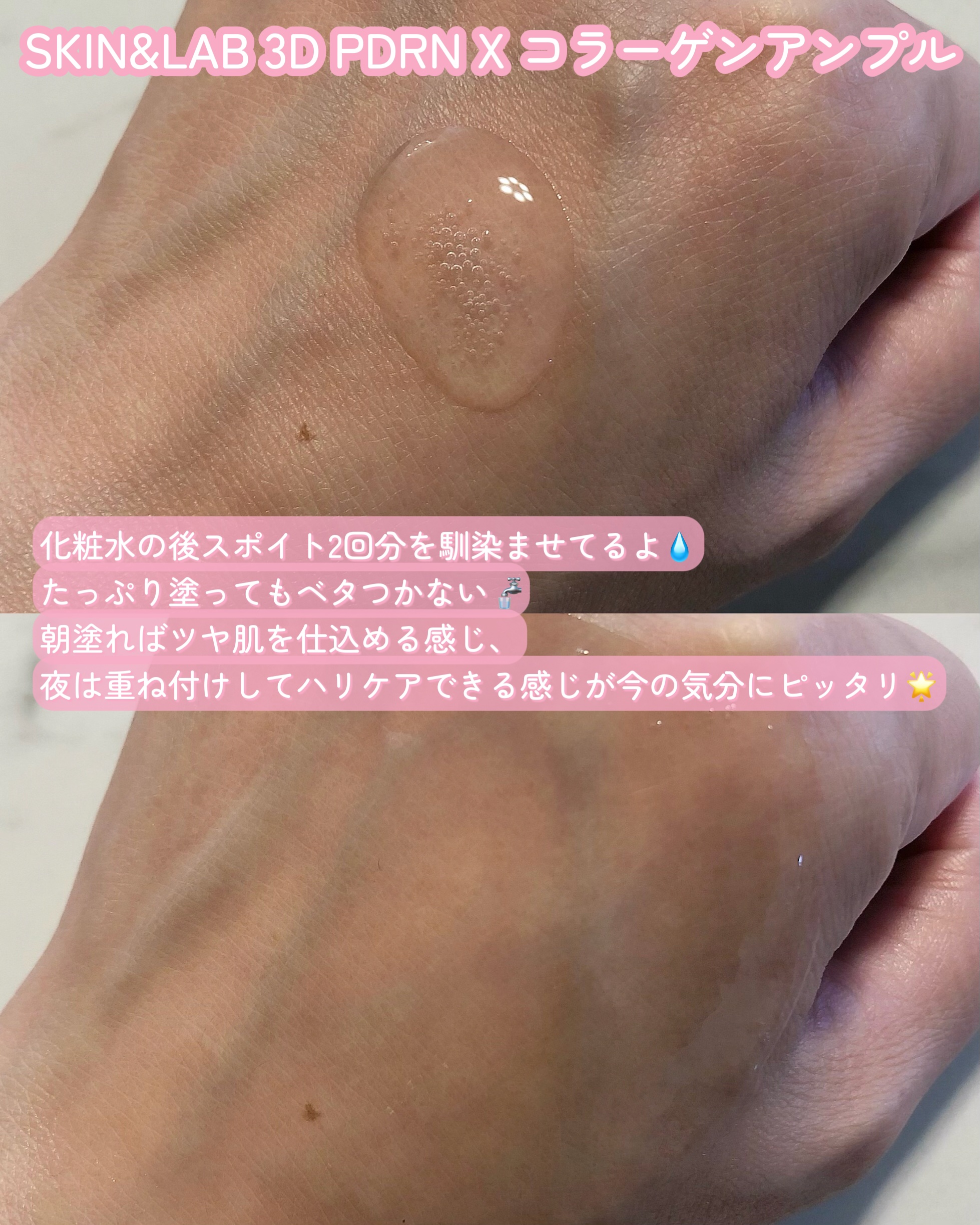 3D PDRN X コラーゲンアンプル/SKIN&LAB/美容液を使ったクチコミ（3枚目）