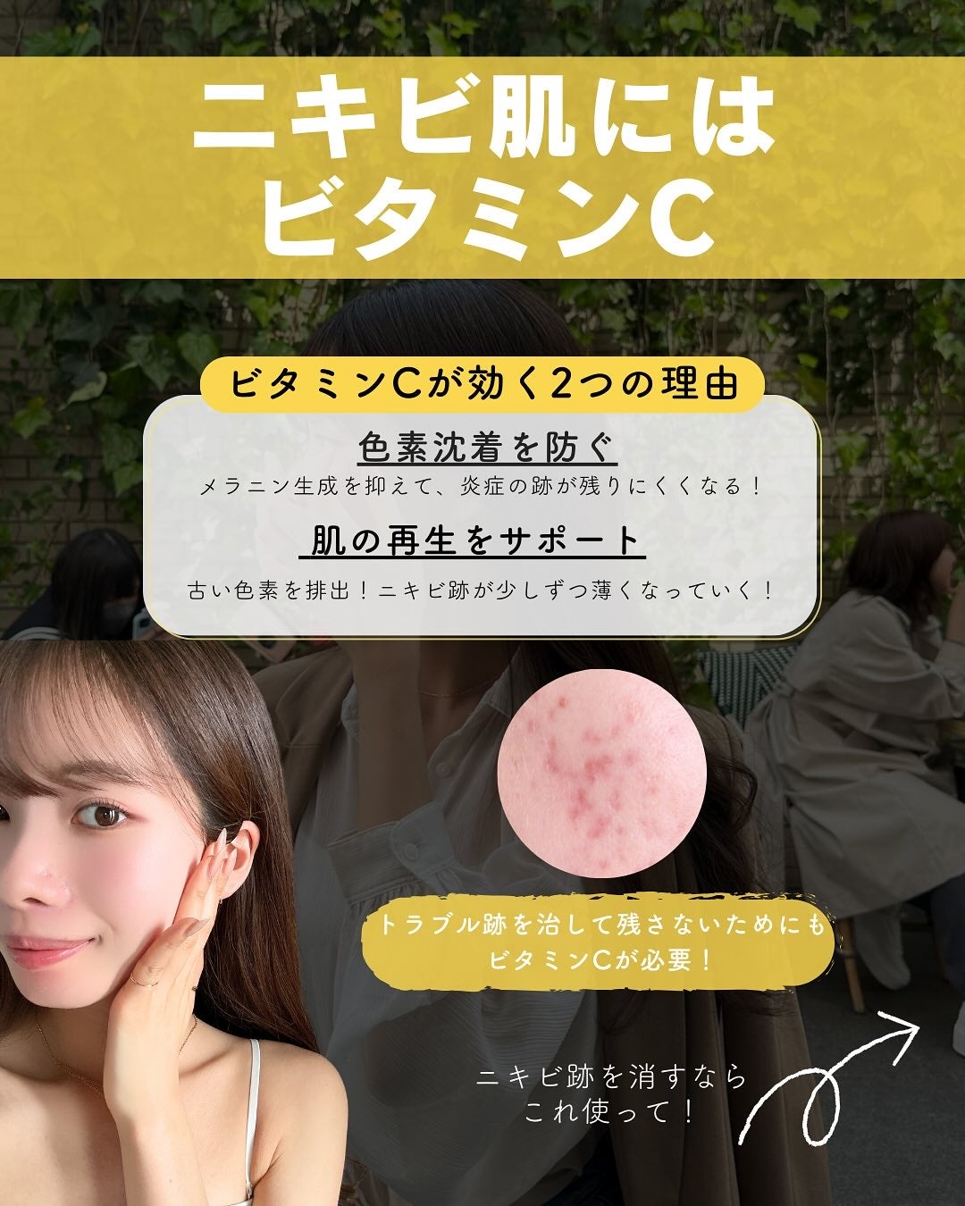 白湯(サユ) | ニキビと戦うOL🤍 on LIPS 「・白湯です🫶🏻ニキビ跡って全然消えなくない?泣ニキビできるのも..」(2枚目)