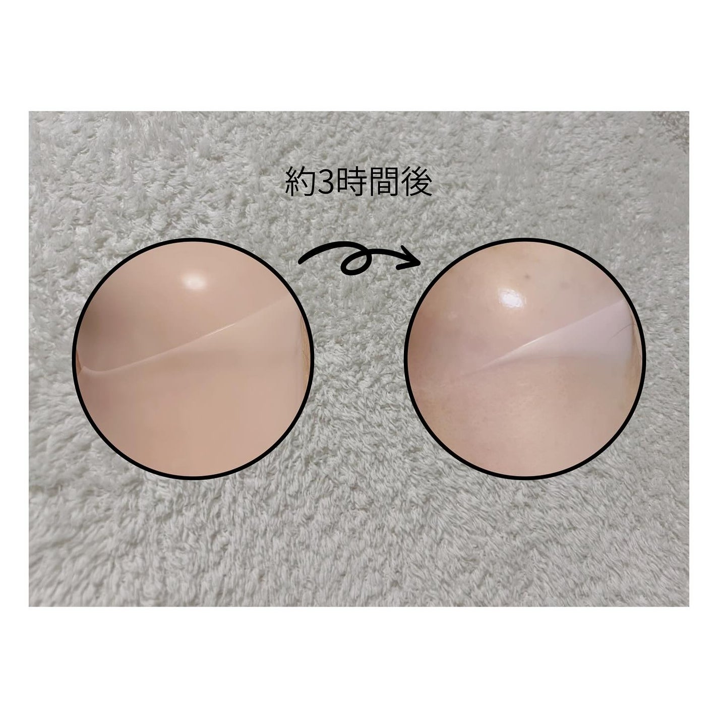 RXザ・アルファアルブチン2 ニキビ跡ケアセラム/COSRX/美容液を使ったクチコミ(4枚目)