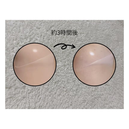 RXザ・アルファアルブチン2 ニキビ跡ケアセラム/COSRX/美容液を使ったクチコミ(4枚目)