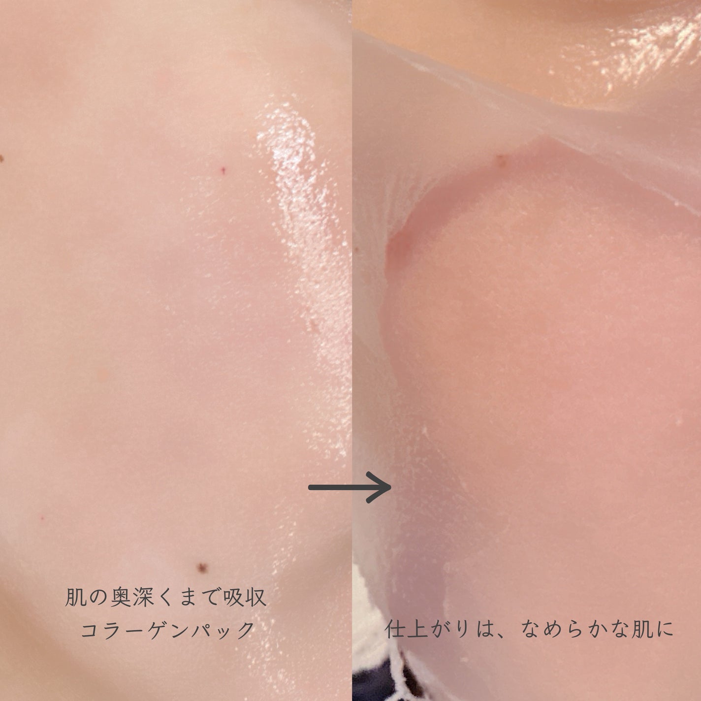 みあ◡̈ フォロバ100 on LIPS 「#PRぴったり密着するコラーゲンでコラーゲンの輝きが長時間持続..」(3枚目)