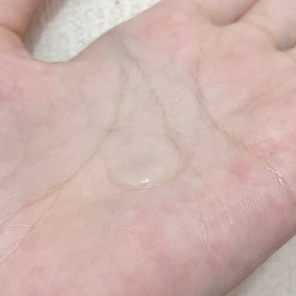 リカAソフト あせもジェル/ユースキン/ボディローションを使ったクチコミ(2枚目)