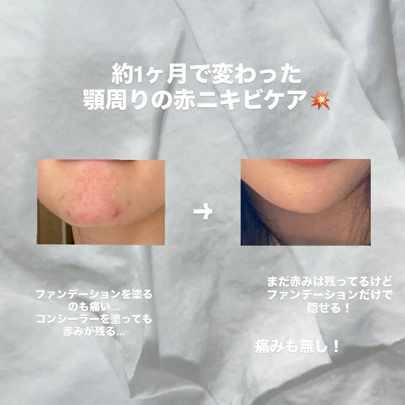 潤浸保湿 美容液/キュレル/美容液を使ったクチコミ(1枚目)