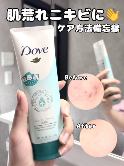 センシティブマイルド洗顔料/ダヴ/洗顔フォームを使ったクチコミ(1枚目)