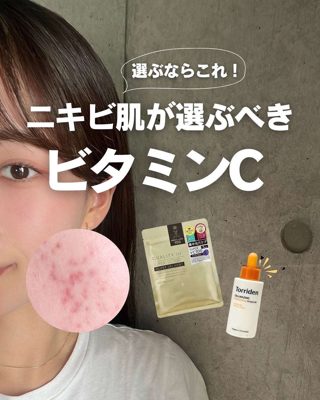 白湯(サユ) | ニキビと戦うOL🤍 on LIPS 「・白湯です🫶🏻ニキビ跡って全然消えなくない?泣ニキビできるのも..」(1枚目)