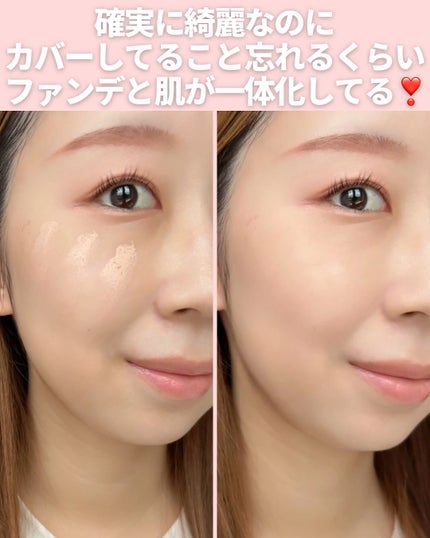 mii♡イエベ春🌸フェミニン on LIPS 「@miichan.cosme👈🏻その他のコスメ情報はこちら💖K..」(5枚目)