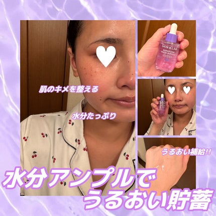 バリアダームリンガーアンプル/SKIN&LAB/美容液を使ったクチコミ(2枚目)