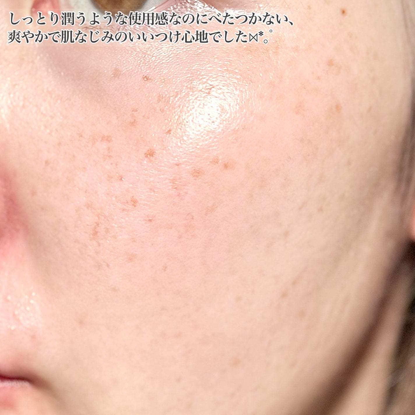 ウォータリー ヒアル セラム/Real Barrier/美容液を使ったクチコミ(5枚目)