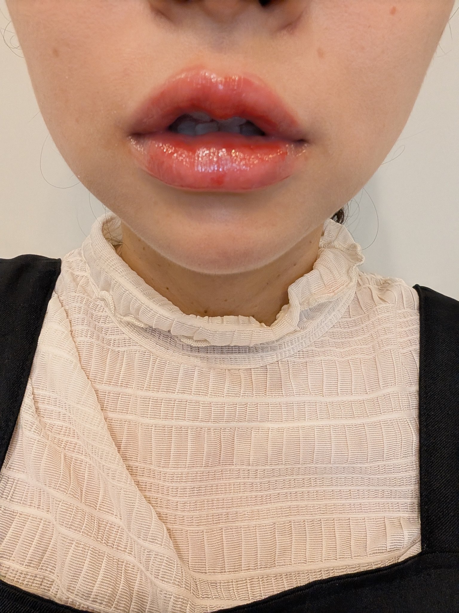 ジューシーデューイグロウティント/dasique/リップティントを使ったクチコミ（3枚目）