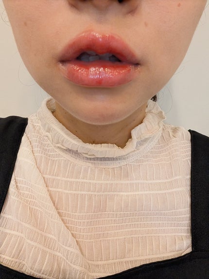 ジューシーデューイグロウティントミニ/dasique/リップティントを使ったクチコミ(3枚目)