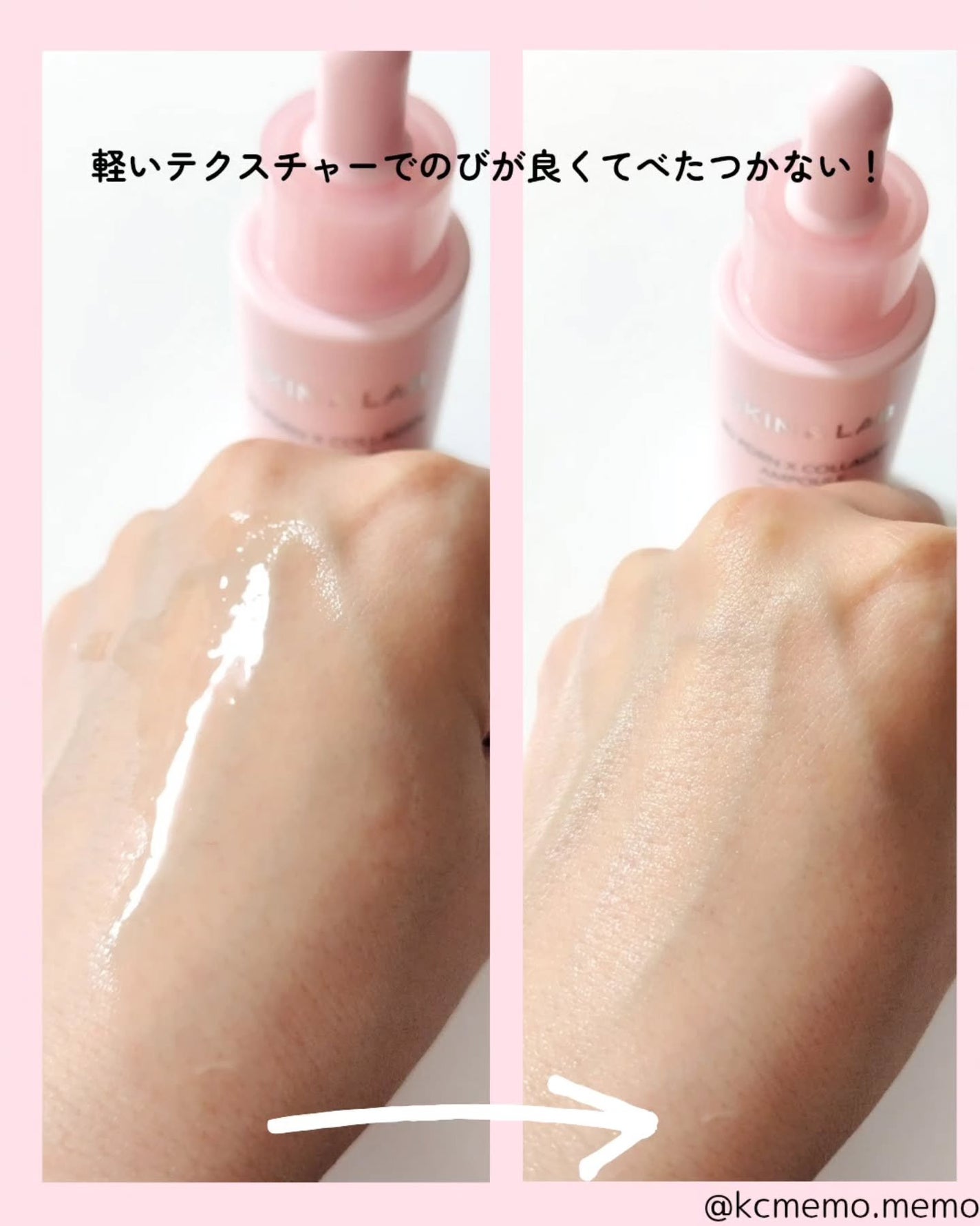 3D PDRN X コラーゲンアンプル/SKIN&LAB/美容液を使ったクチコミ(4枚目)