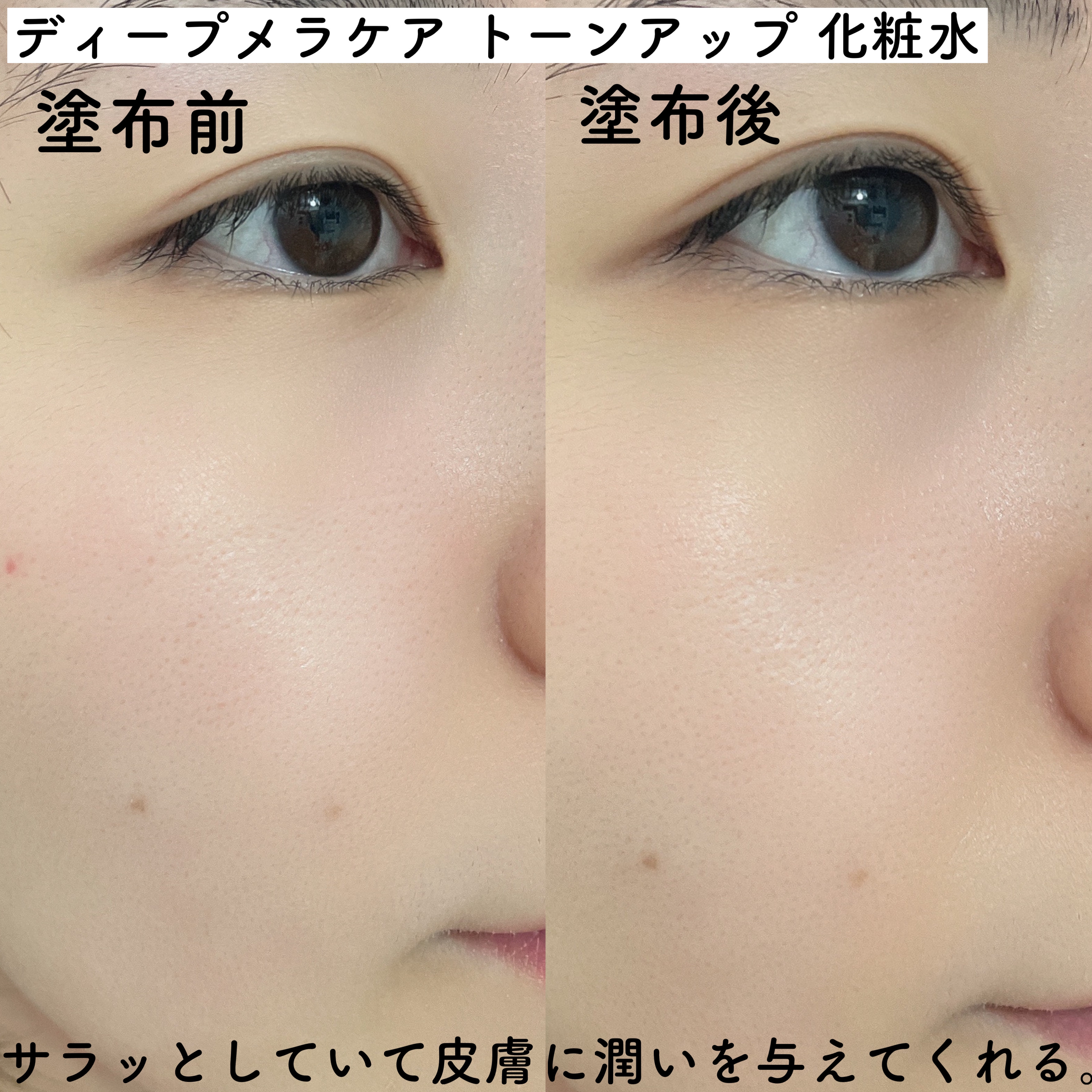 ディープ メラケア 美容液/Mildlab/美容液を使ったクチコミ（3枚目）