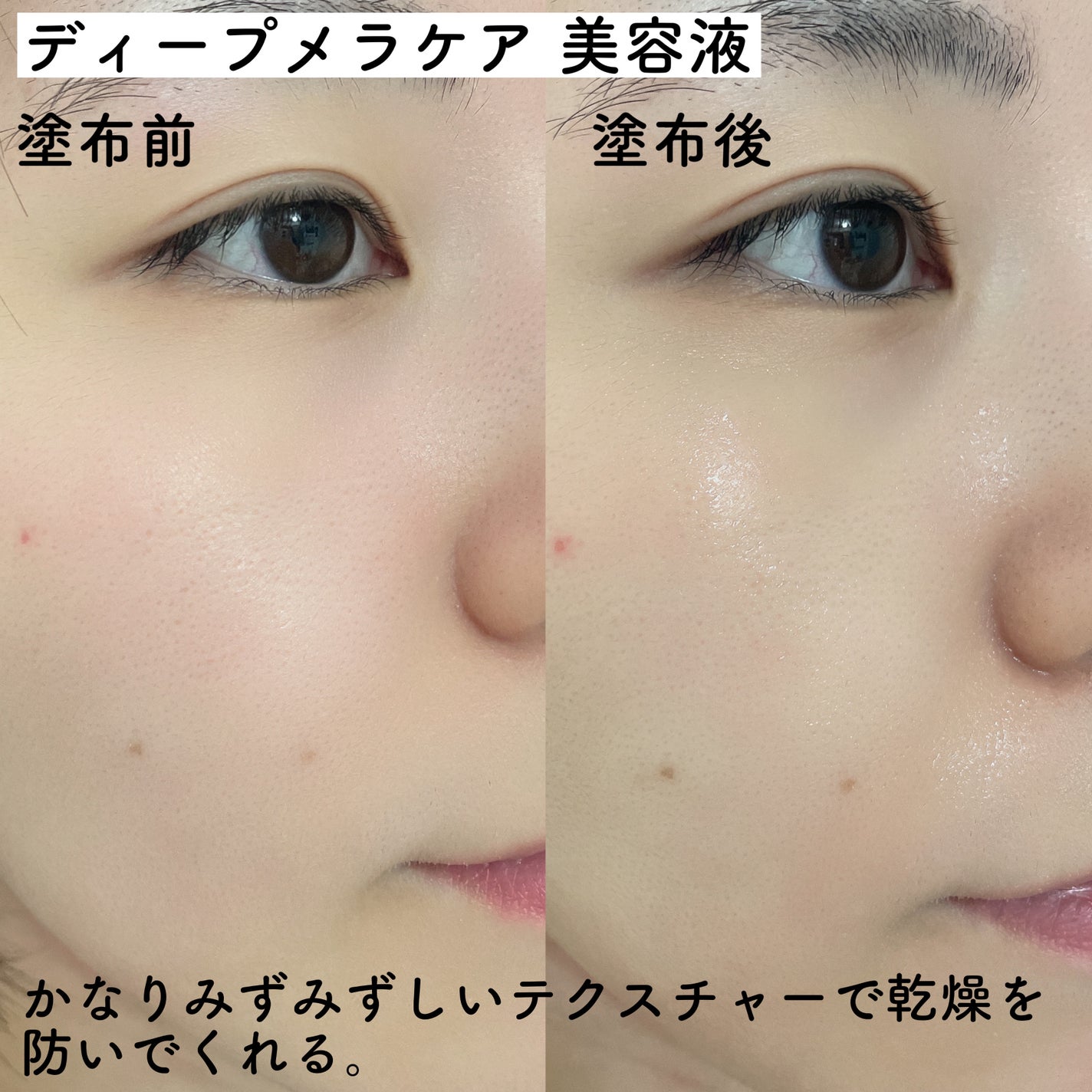 ディープ メラケア 美容液/Mildlab/美容液を使ったクチコミ(4枚目)