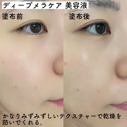 ディープ メラケア 美容液/Mildlab/美容液を使ったクチコミ(4枚目)