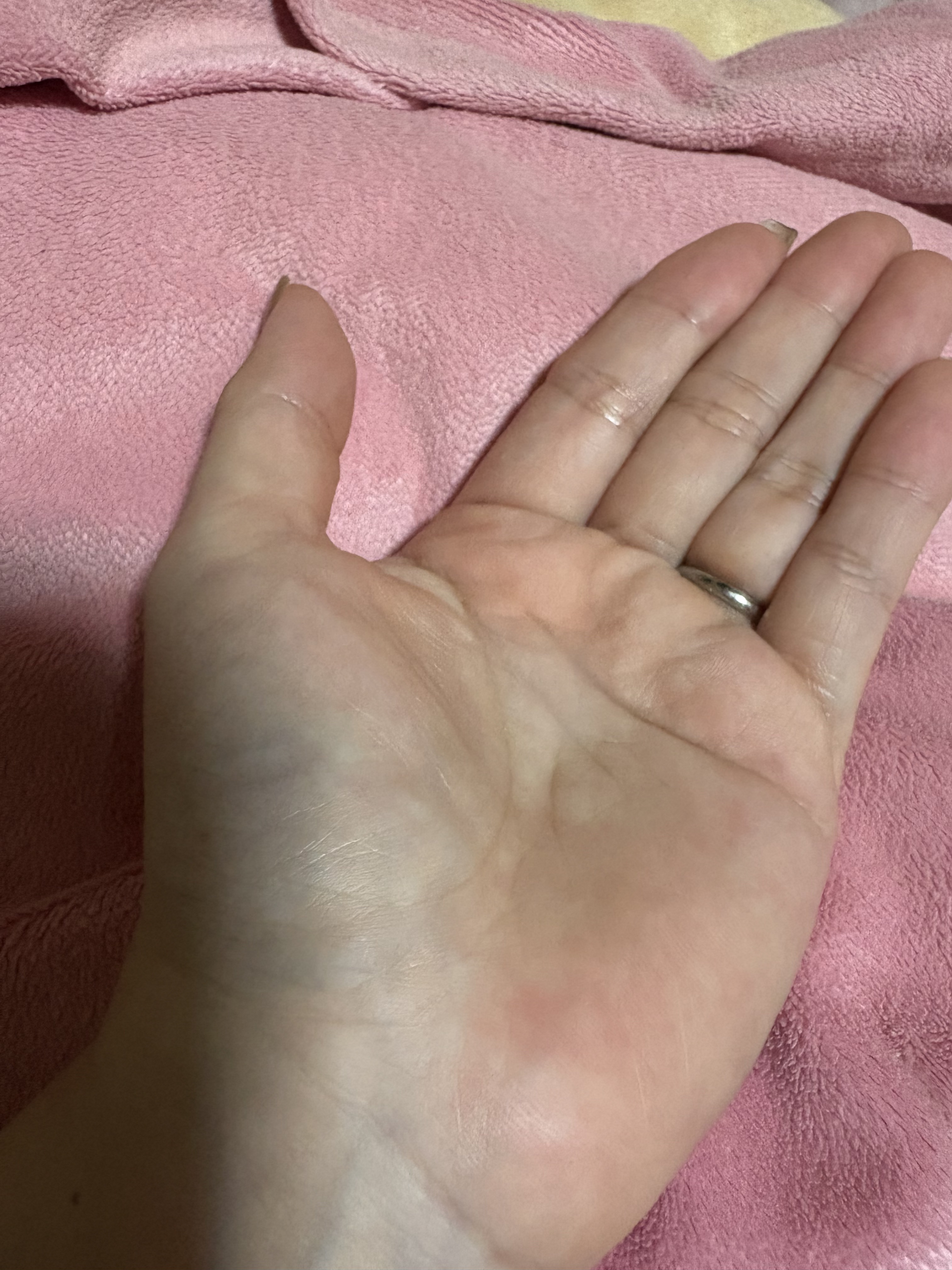 パーフェクトワン モイスチャーセラム/パーフェクトワン/オールインワン化粧品を使ったクチコミ（2枚目）