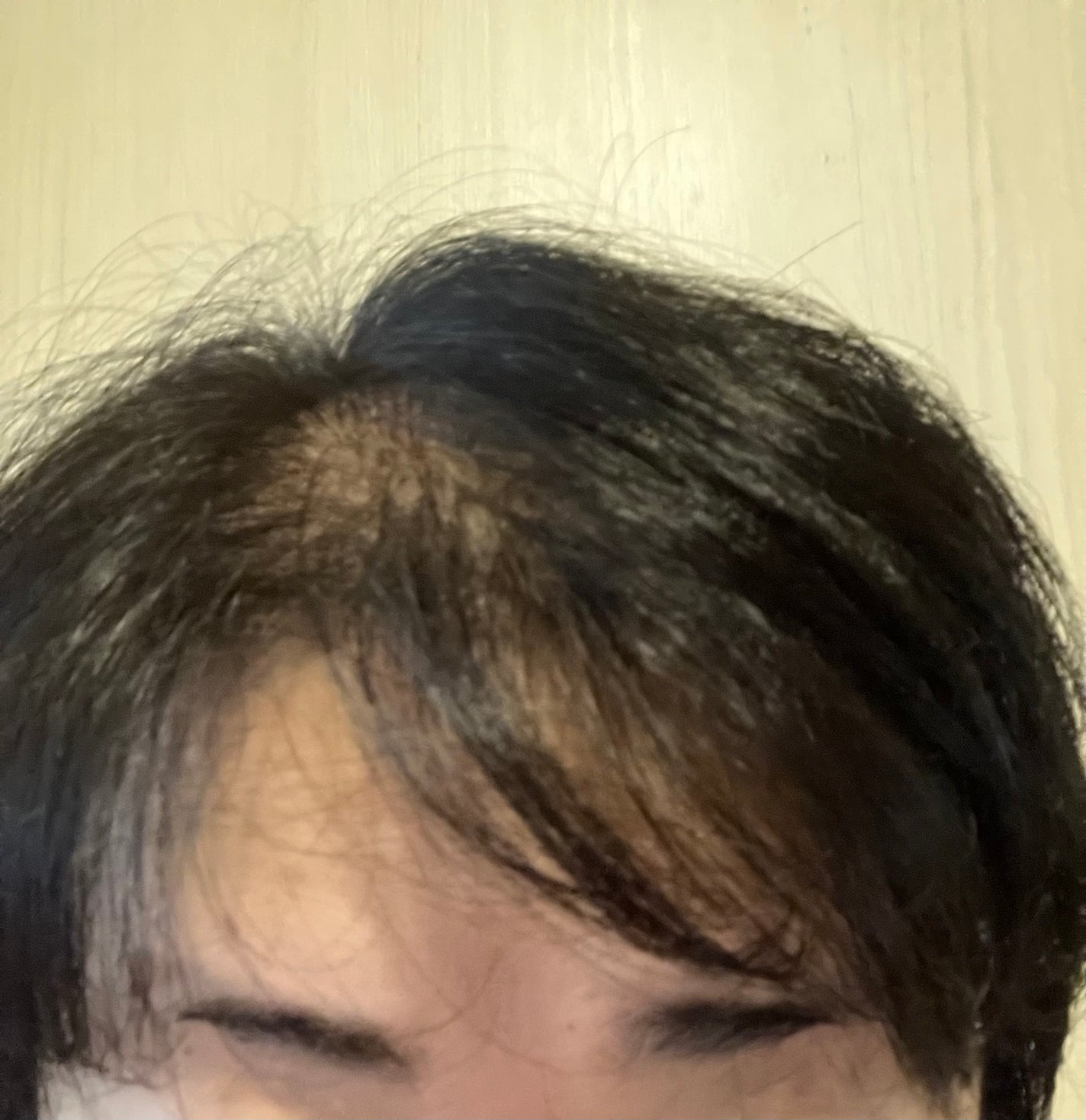 アルガネーゼ オイルインカラートリートメント/ウィルミナ/ヘアカラーを使ったクチコミ(6枚目)