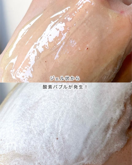 ダーマアールエックス カム アクティブ クレンザー/OGANACELL/クレンジングジェルを使ったクチコミ(3枚目)