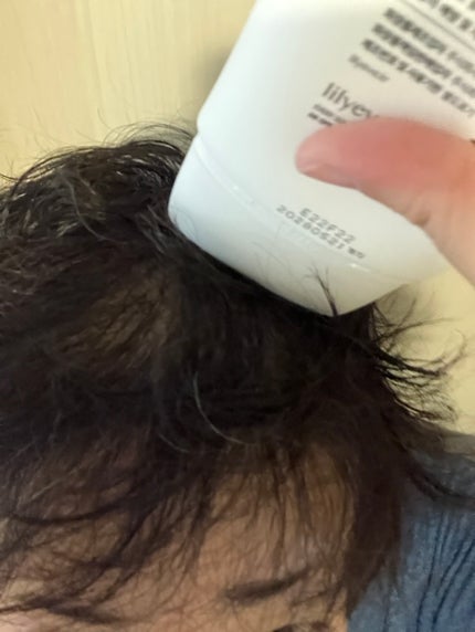 グローターン 100ml/リリーイブ/頭皮ローションを使ったクチコミ(5枚目)