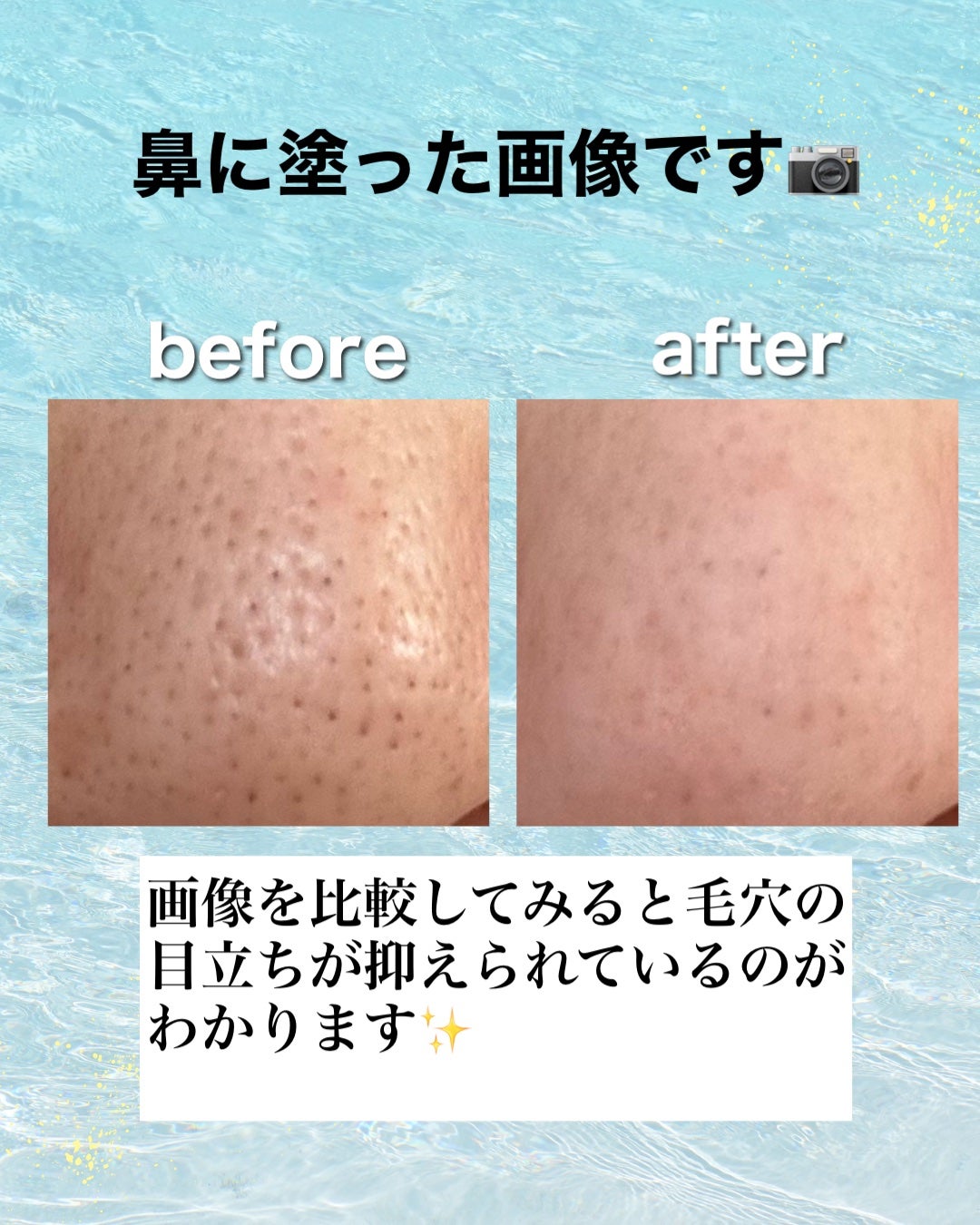 ポアカバー C/ポイントマジックPRO/化粧下地を使ったクチコミ(3枚目)