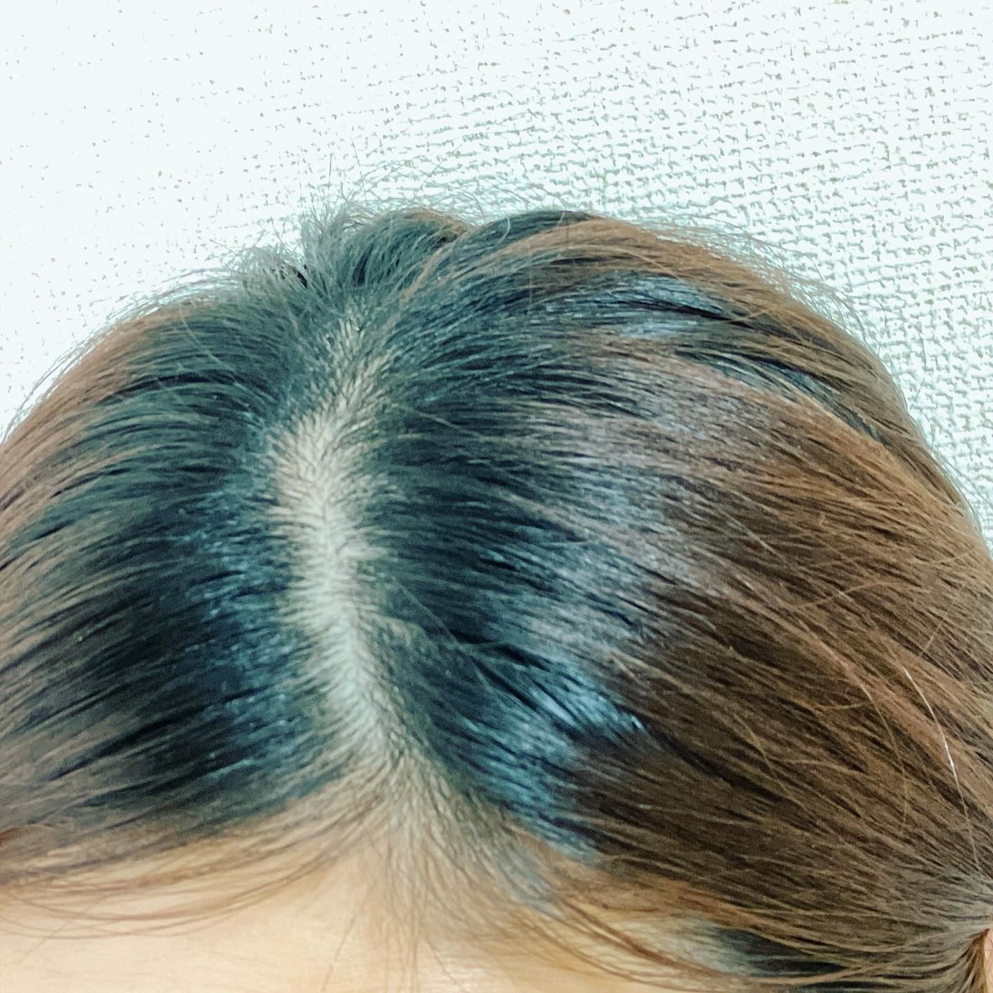 SonoRepro/アンファー(スカルプD)/ヘアケアグッズを使ったクチコミ(5枚目)