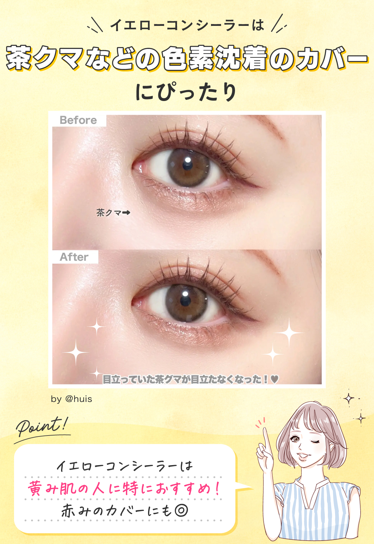 イエローコンシーラーは茶クマなどの色素沈着のカバーにぴったり。イエローコンシーラーは黄み肌の人に特におすすめ！赤みがカバーにも◎