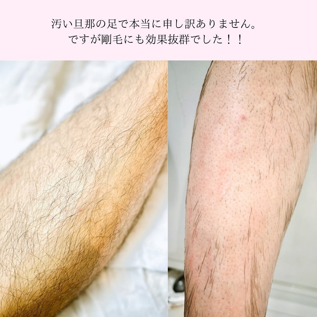 ジョモリッチ/鎌倉ライフ/除毛クリームを使ったクチコミ(2枚目)