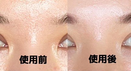 レチビタエッセンスマスク/ピュレア/シートマスク・パックを使ったクチコミ(1枚目)