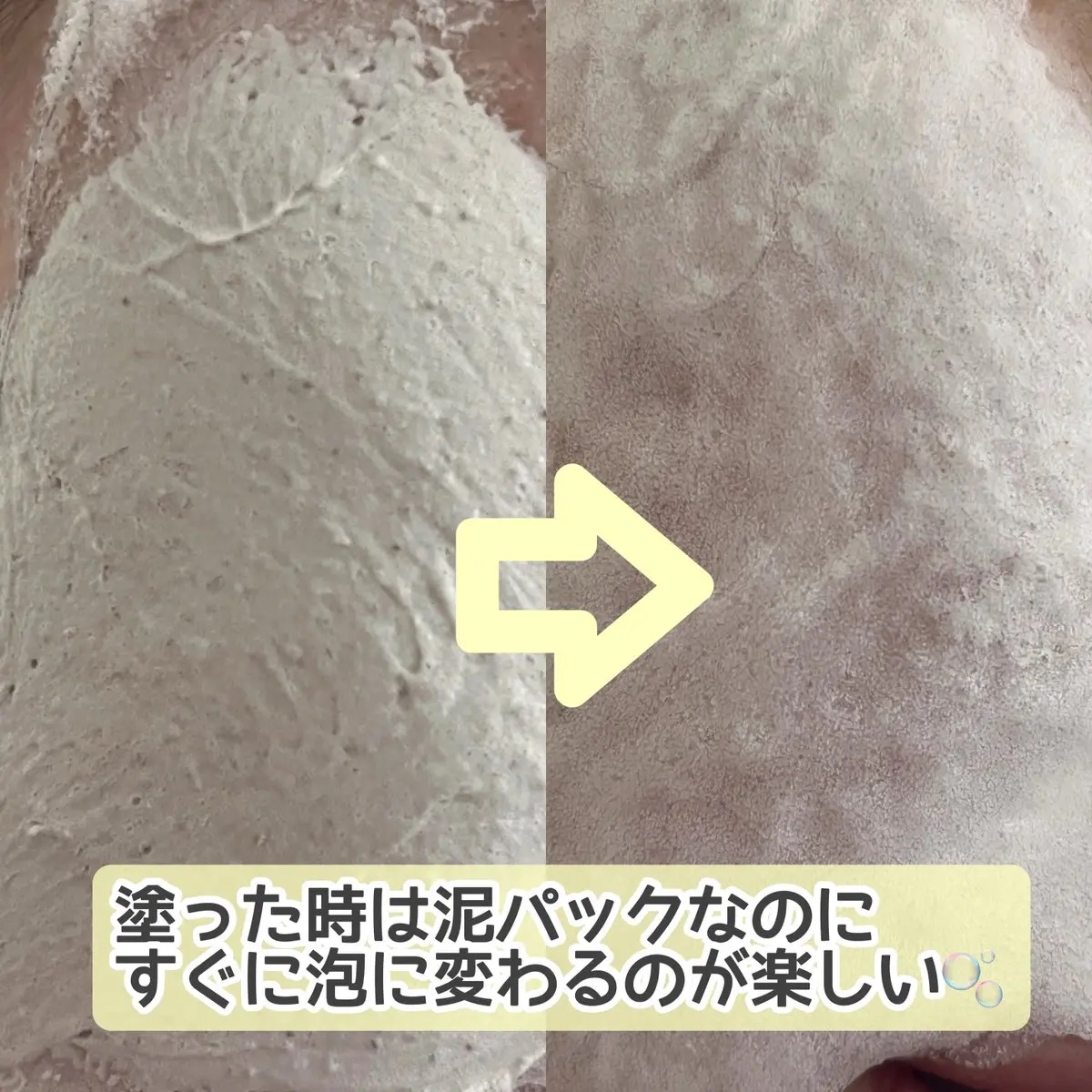 ブレミッシュバブルマッドマスク/PAPA RECIPE/スクラブ・ゴマージュを使ったクチコミ（2枚目）