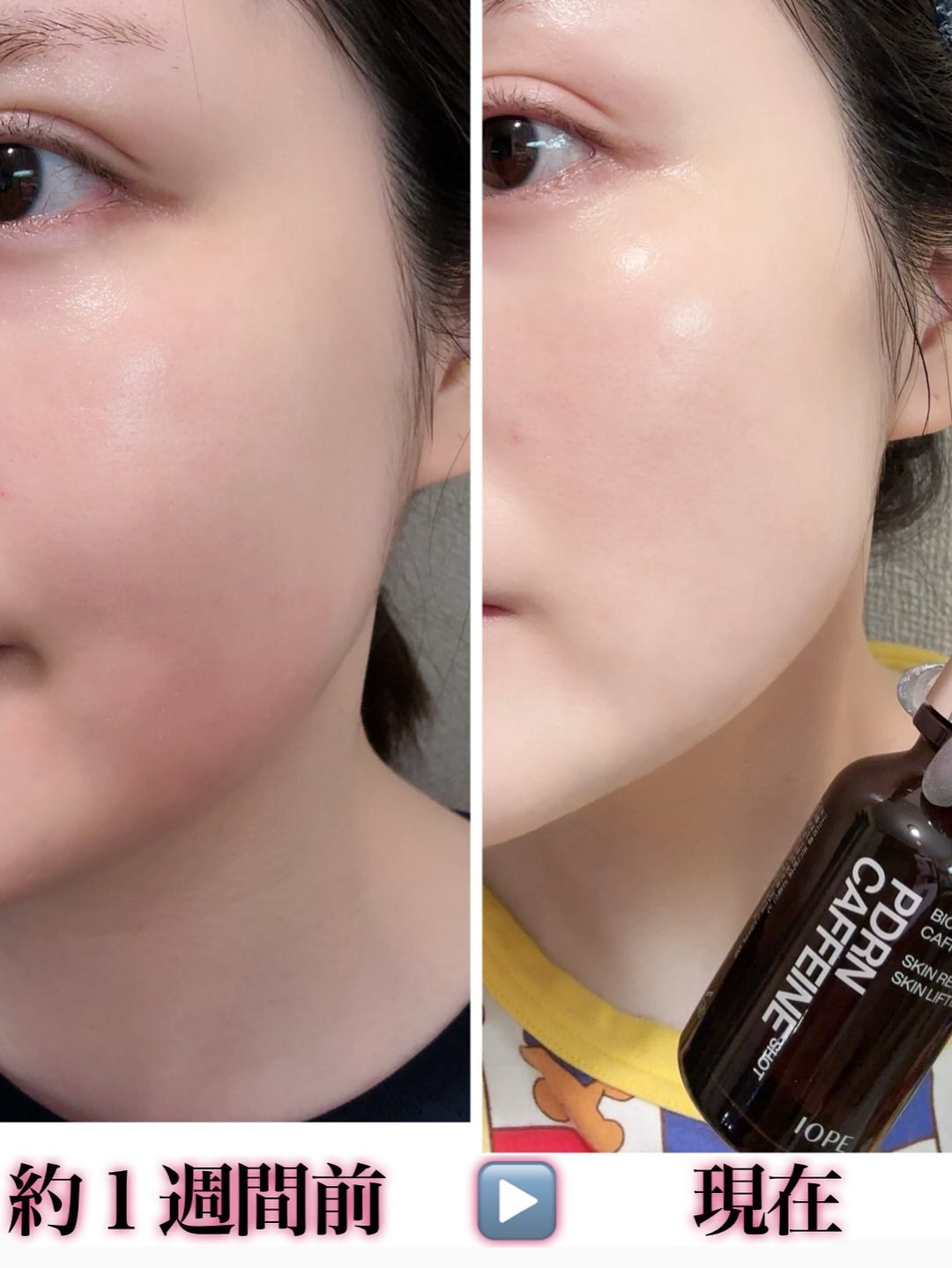 PDRNカフェインショット/IOPE/美容液を使ったクチコミ(2枚目)