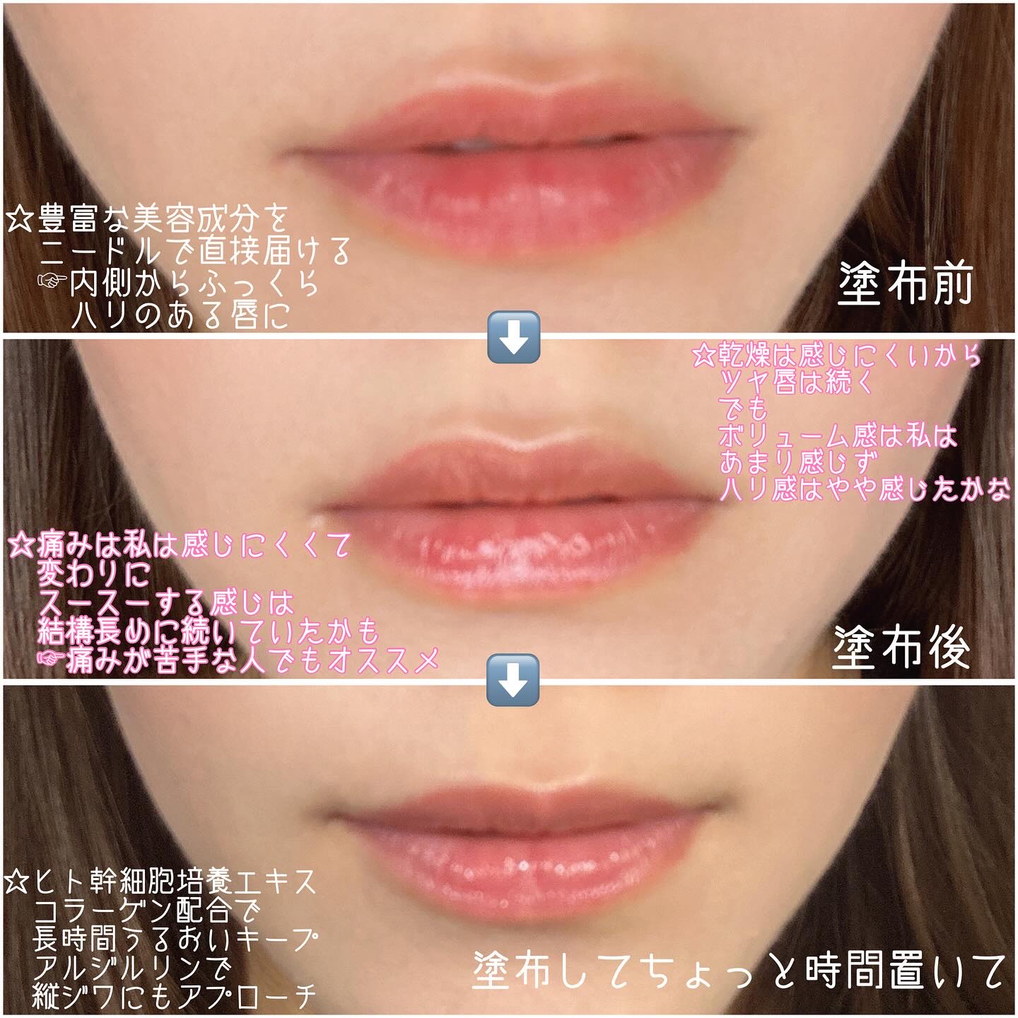 キューミ―ボムショットリッププランパー/AGARISM/リッププランパーを使ったクチコミ（3枚目）