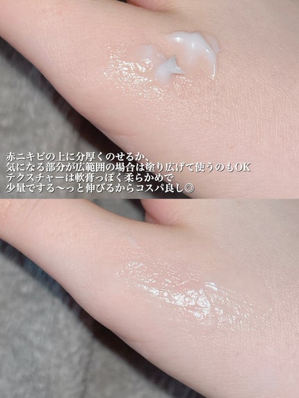 ガーリック リードルショット スポットクリーム/VT/フェイスクリームを使ったクチコミ(4枚目)