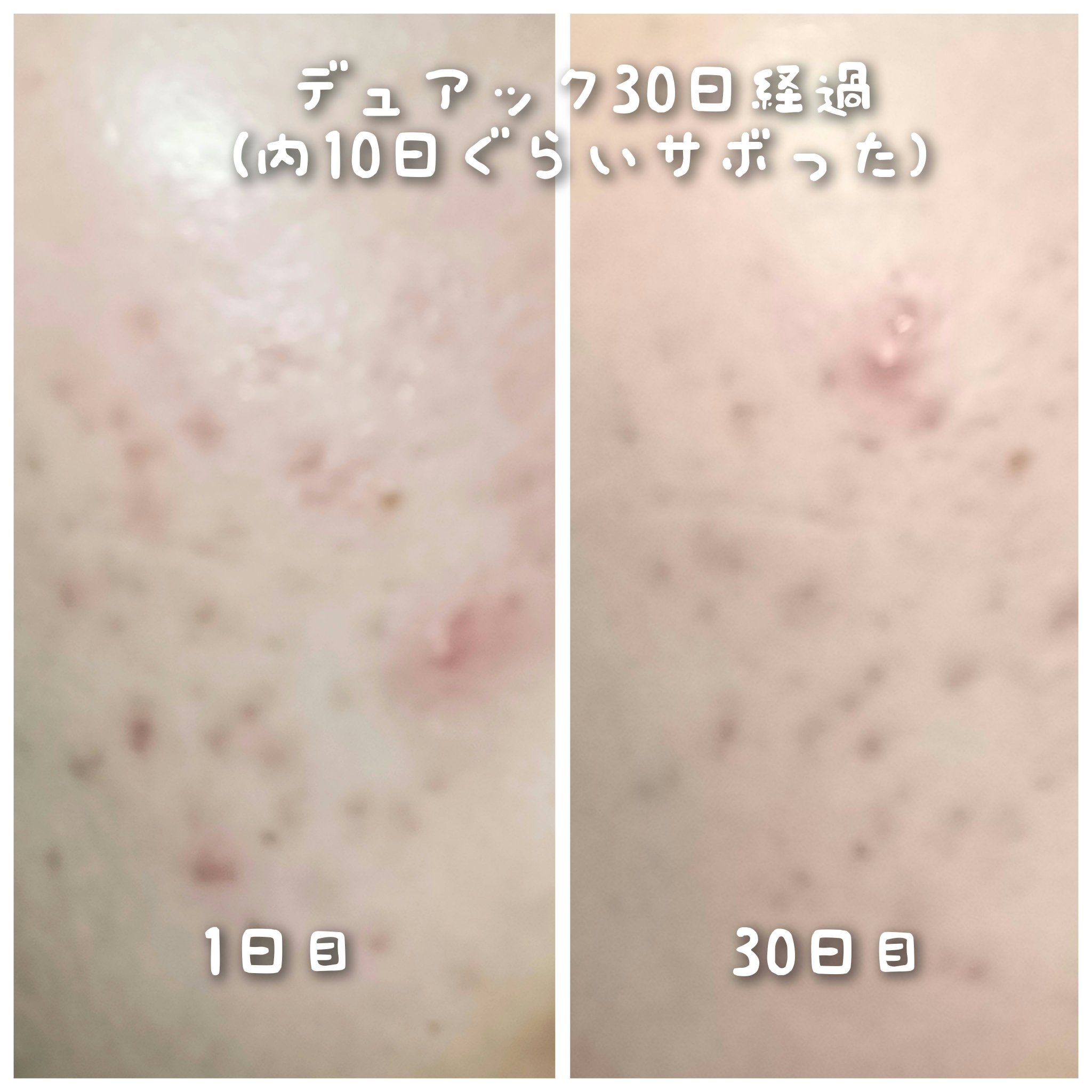 ワンダーリリーフ センテラ セラム アンセンティド/Purito Seoul/美容液を使ったクチコミ（1枚目）