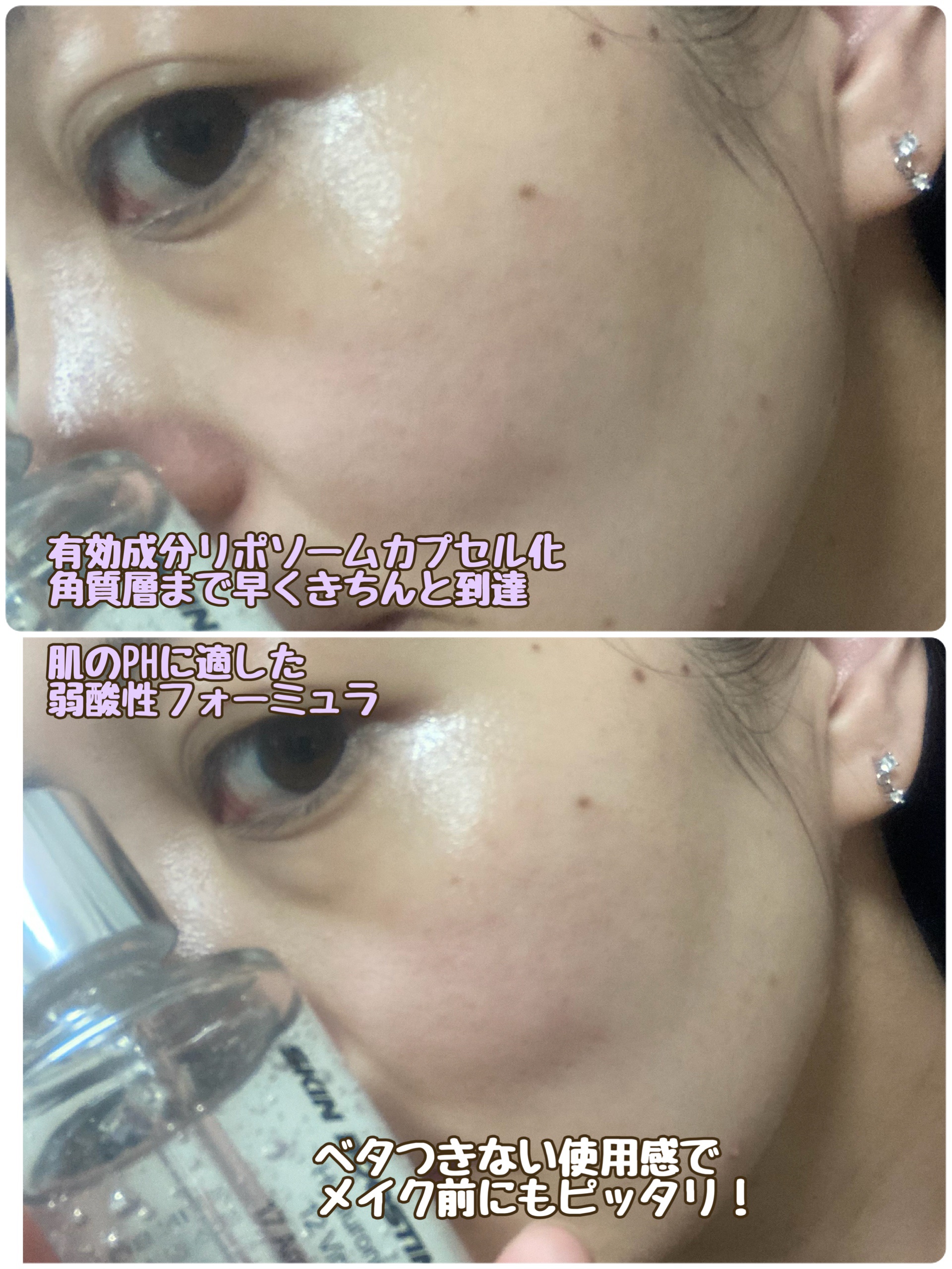 スキンブースティングフォルテセラム/essenciel/美容液を使ったクチコミ（3枚目）