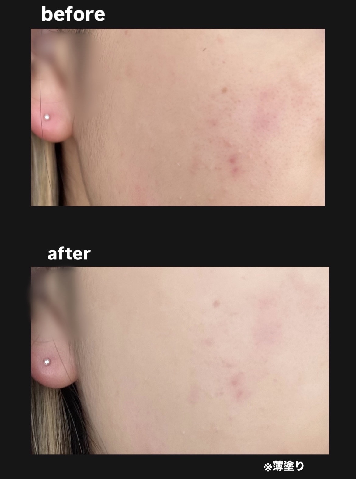 キス クッションパンチ/KiSS/クッションファンデーションを使ったクチコミ（3枚目）