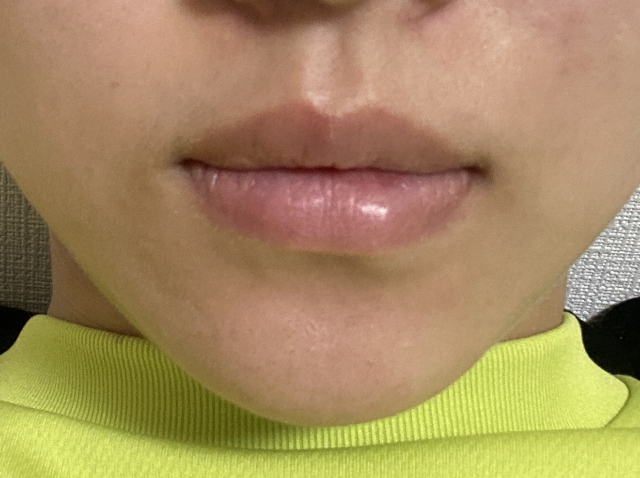 リードルS リッププランパーエキスパート/VT/リッププランパーを使ったクチコミ（3枚目）