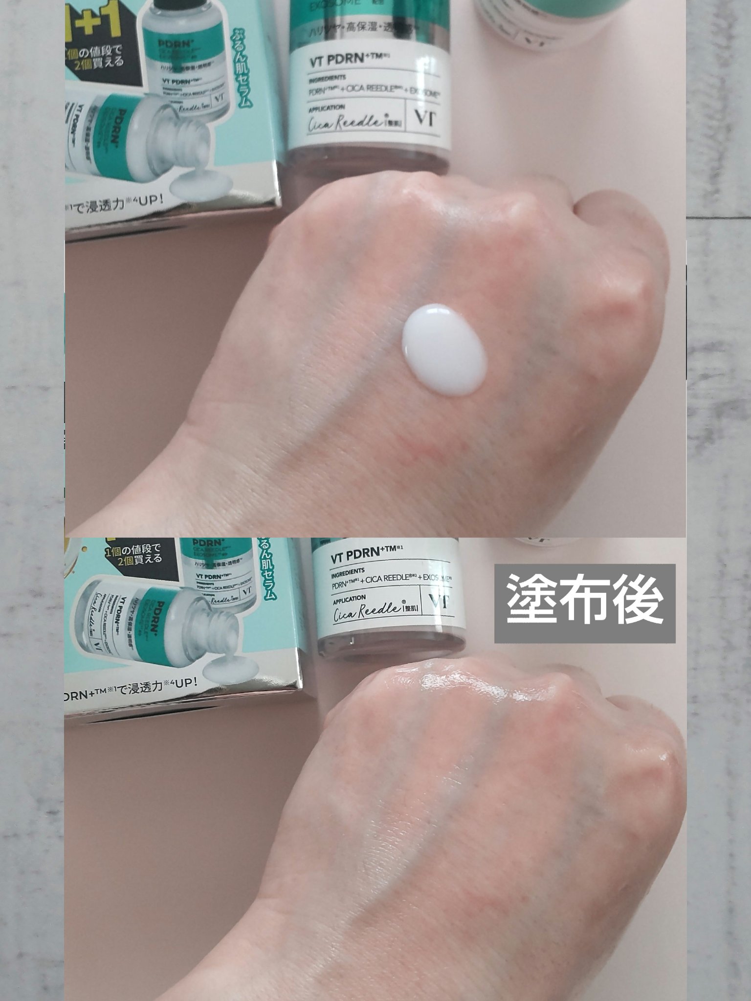 リードルS PDRN+ セラム 1+1（30mL×2個）/VT/美容液を使ったクチコミ（2枚目）