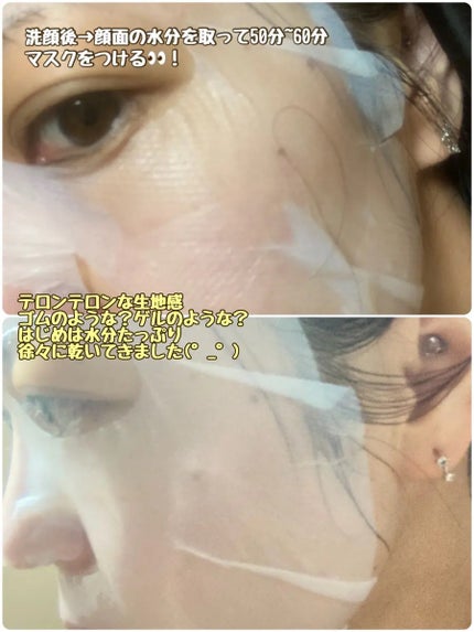 トラブルパッチマスク/EIOM/その他スキンケアを使ったクチコミ(2枚目)