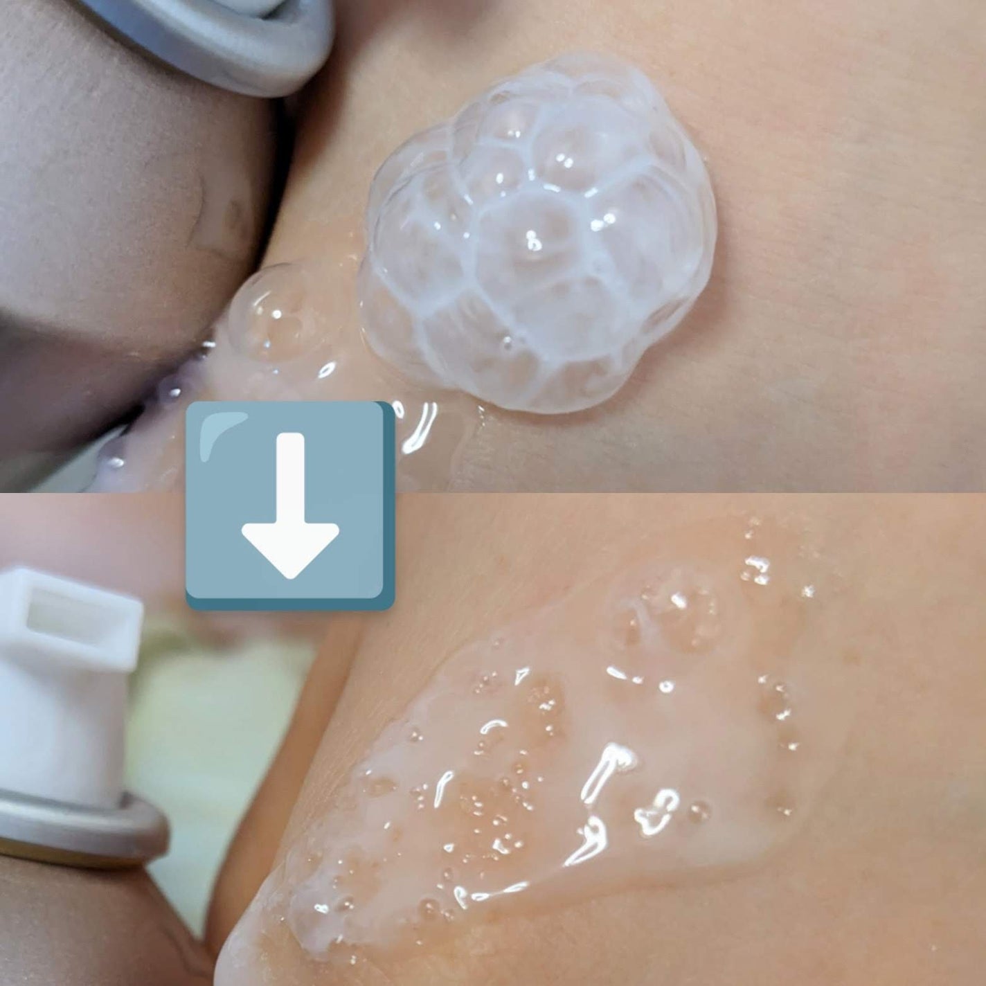 DEOPATI ワキ用スパークリング洗浄料/マックス/デオドラント・制汗剤を使ったクチコミ(3枚目)