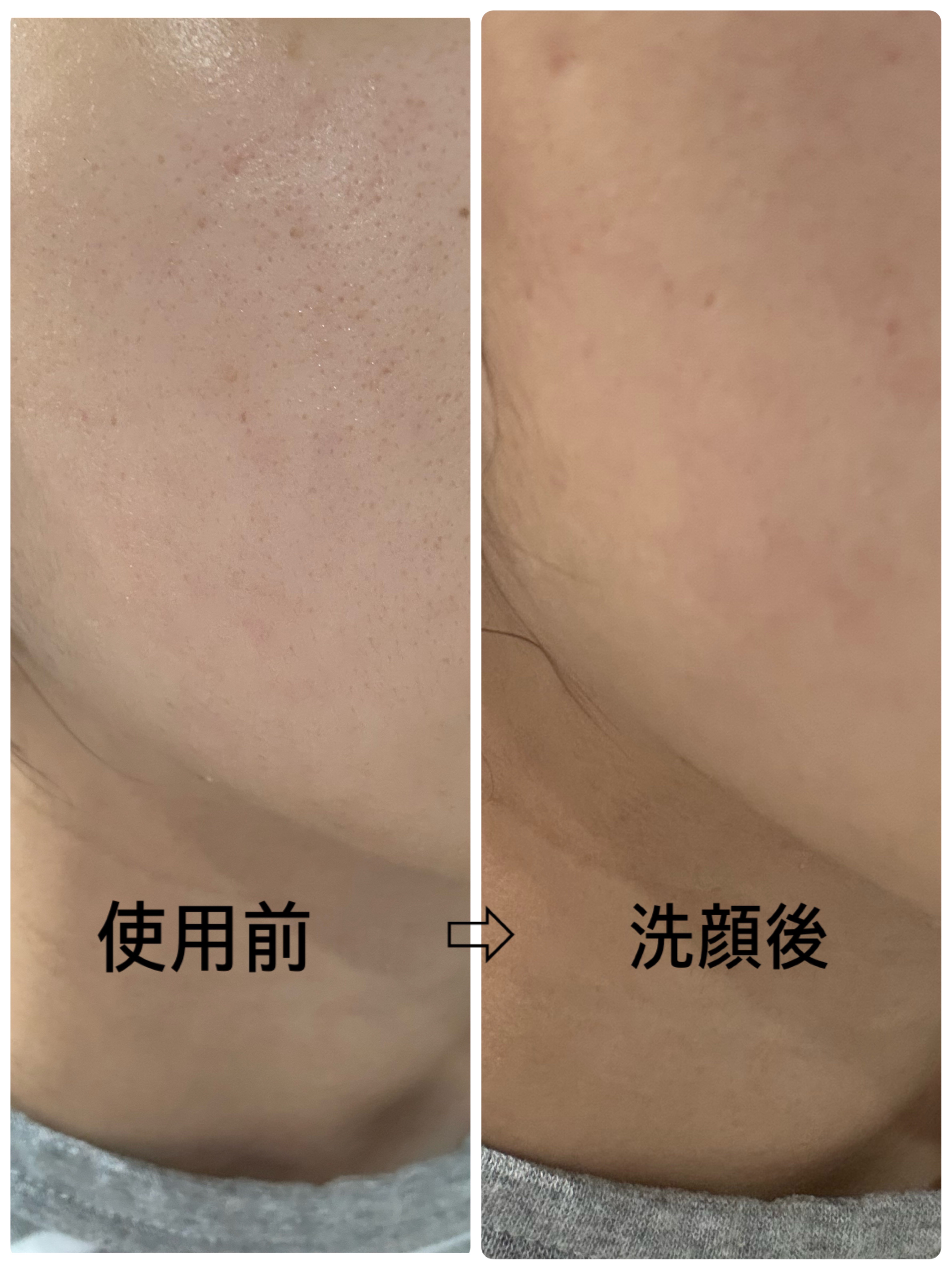 マンナンジェリーハイドロウォッシュ R/PLUEST/洗顔料を使ったクチコミ（2枚目）